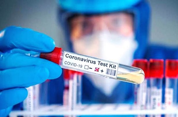 COVID-19 Test