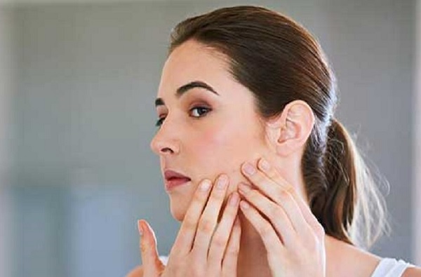 Home Remedies । त्वचेवरील रेडनेस कमी करण्यासाठी घरगुती उपाय